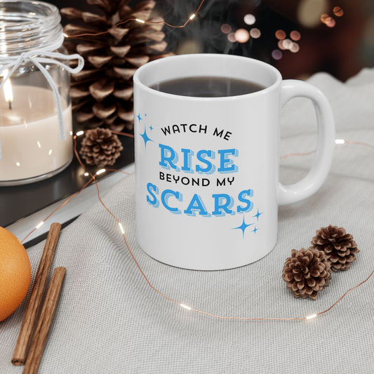 Watch Me Rise Beyond My Scars - Personalized Ceramic Mug (11oz) - Custom Coffee Mug, Unique Gift for Him or Her, Customizable Drinkware